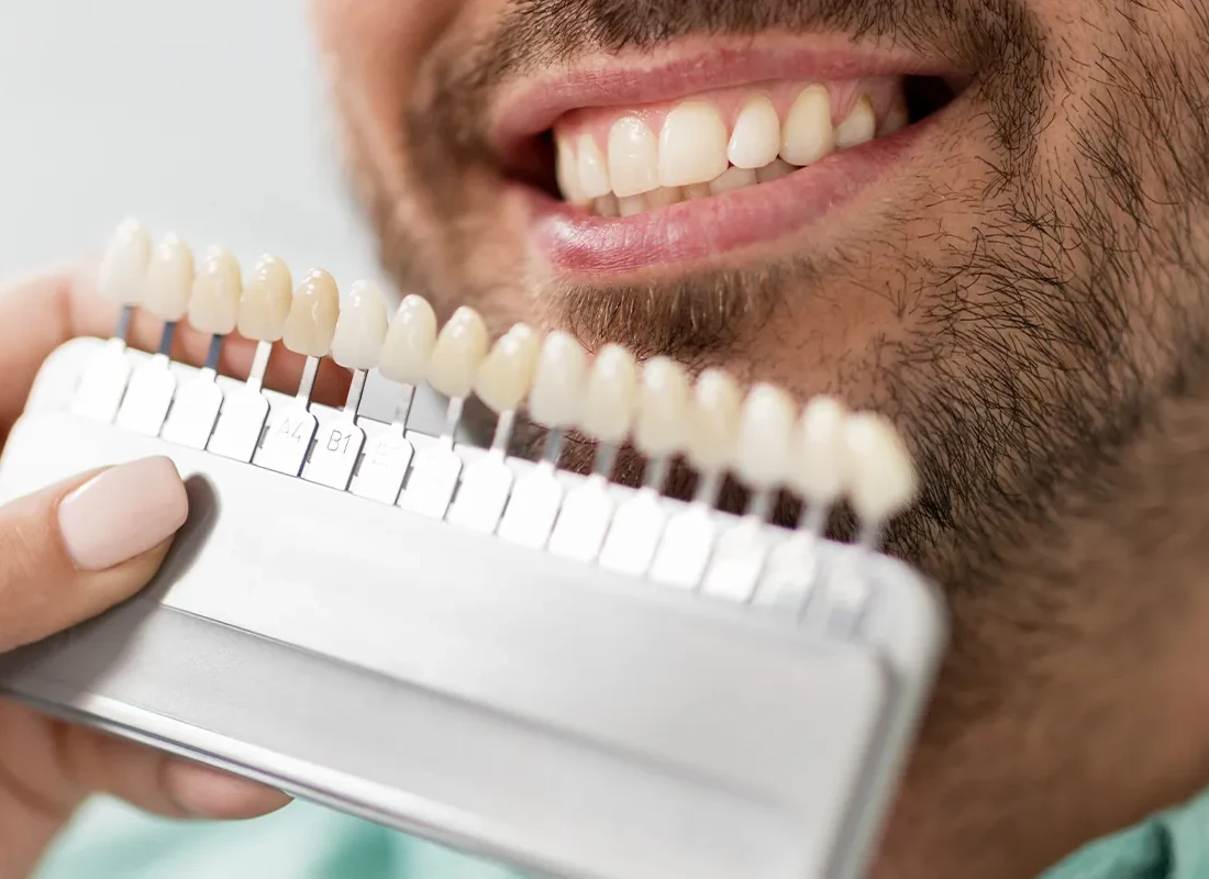 The Role of Gum Recontouring in Periodontal Disease Treatment