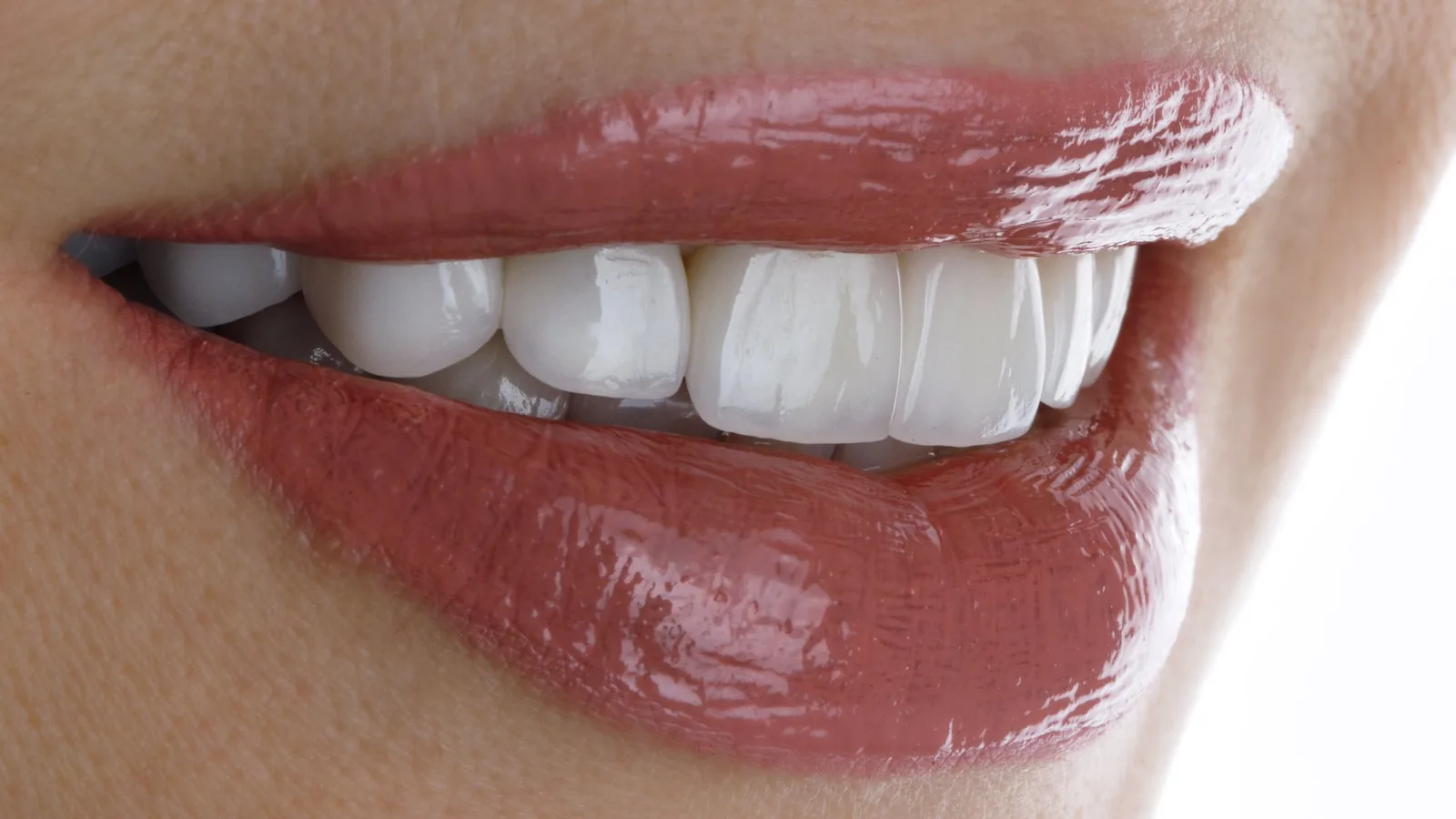 Top 5 Ways to Upgrade Your Smile in Oxnard, CA