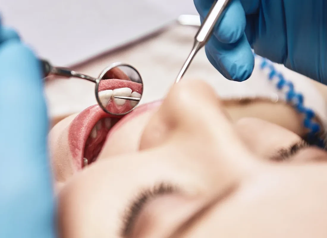 Importance of Dental Cleanings for Routine Dental Care