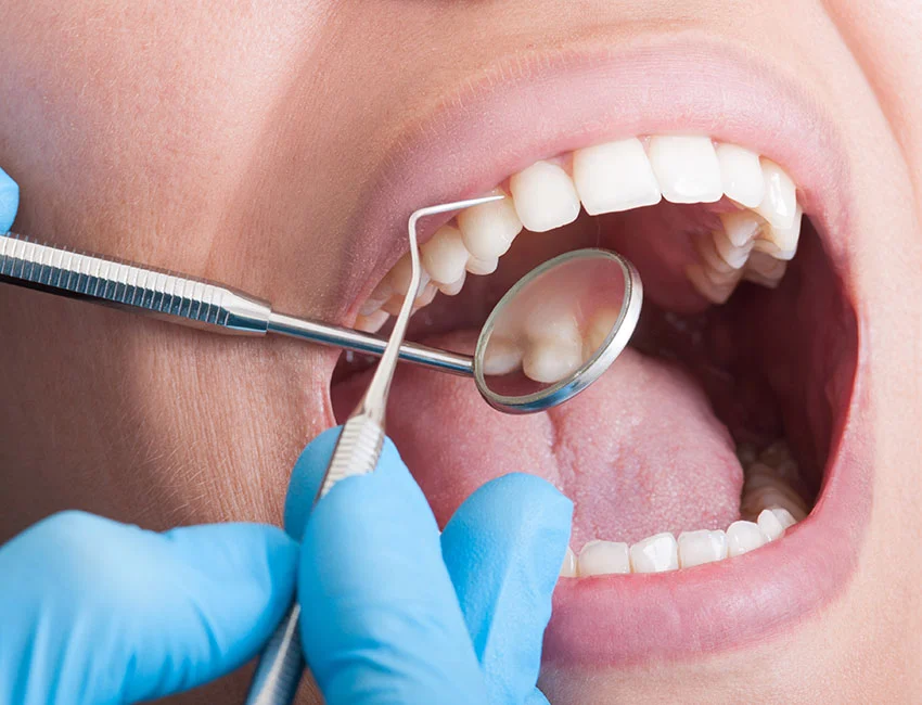 Why Does Menopause Increase My Risk of Tooth Loss?