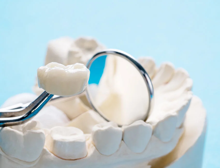 What is Same-Day Dental Crowns