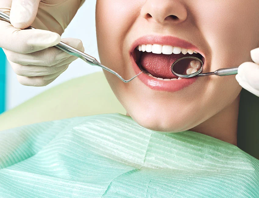 Dental Sealants in Oxnard, CA