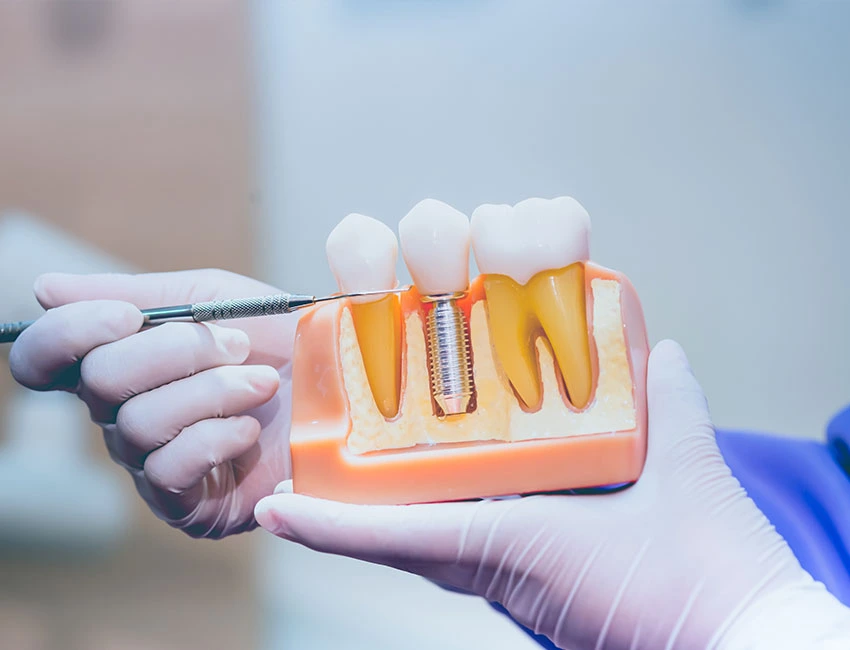 tooth implant complications