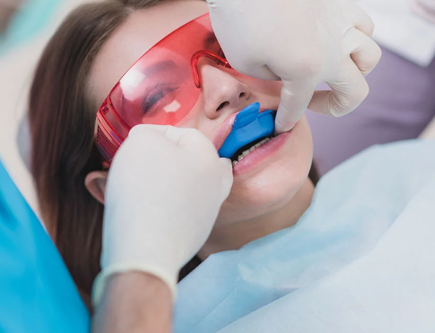 Fluoride Treatments in Oxnard, CA