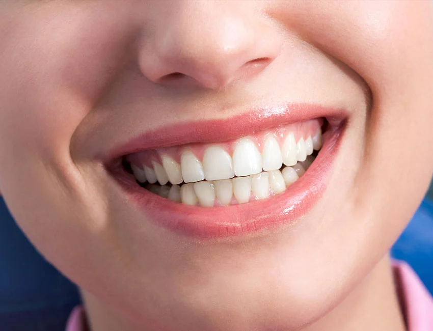 Esthetic Gum Recontouring in Oxnard, CA