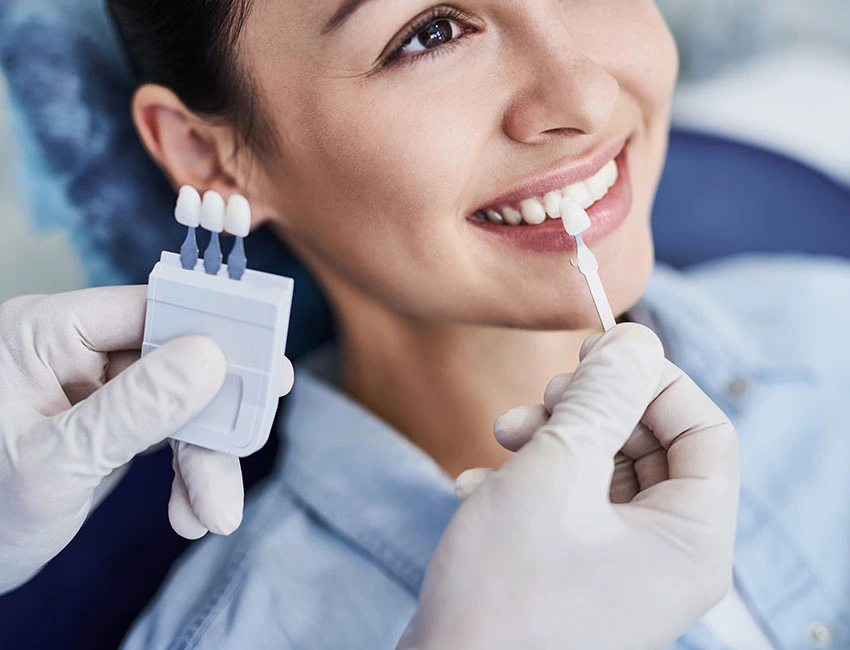 Teeth Whitening in Oxnard, CA