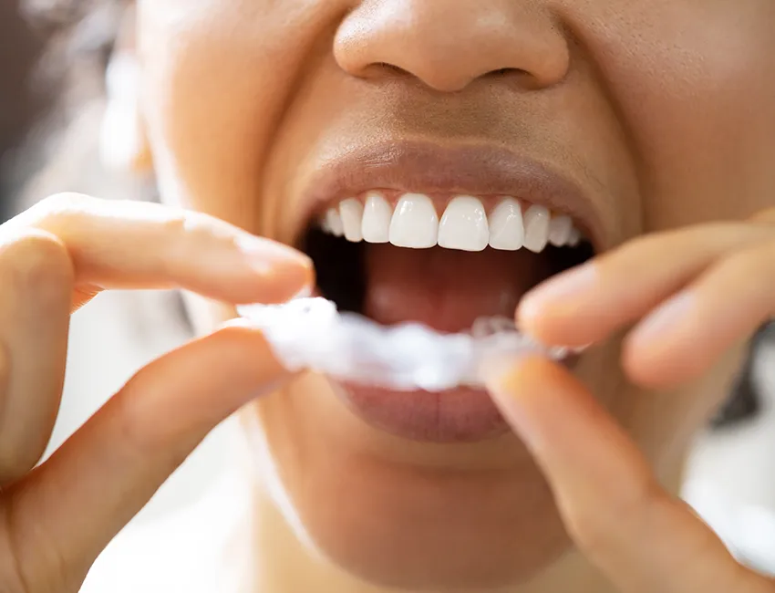 TMJ and Bruxism Treatment in Oxnard, CA
