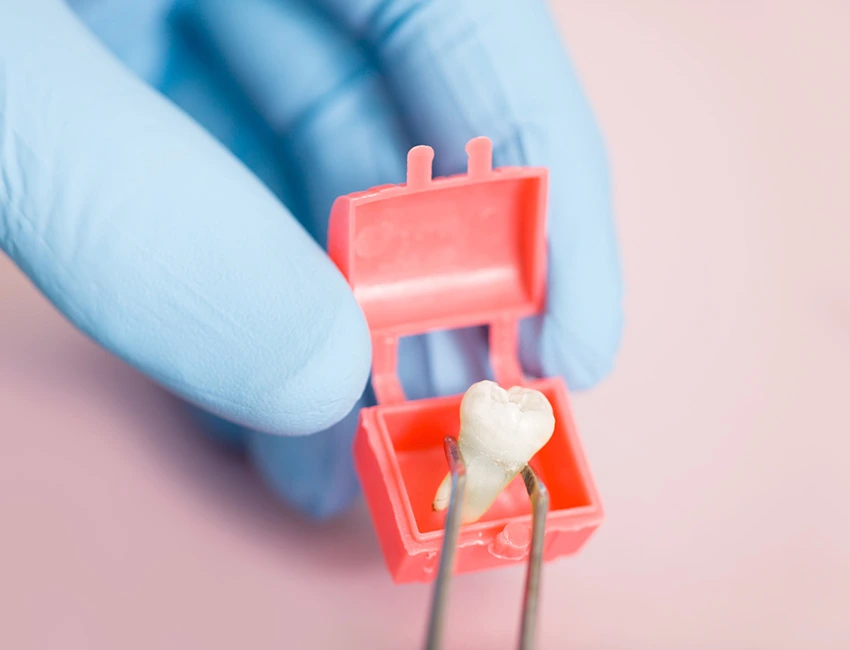 Sinus Lift Surgery: What Patients Need to Know Before Getting Dental Implants